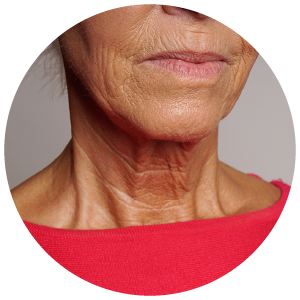 Skin Damage such as Premature Aging, Dark Spots and Skin Cancer